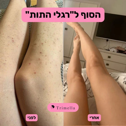 סכין גילוח מתקדמת לעור חלק ללא גירויים ושערות חודרניות - Silk Razor