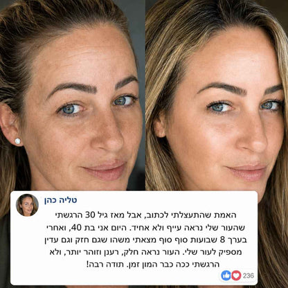נמאס לך להיראות עייפה גם אחרי שישנת?