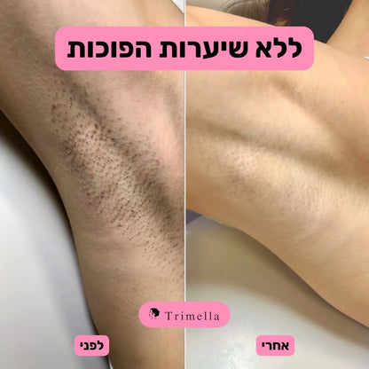 סכין גילוח מתקדמת לעור חלק ללא גירויים ושערות חודרניות - Silk Razor