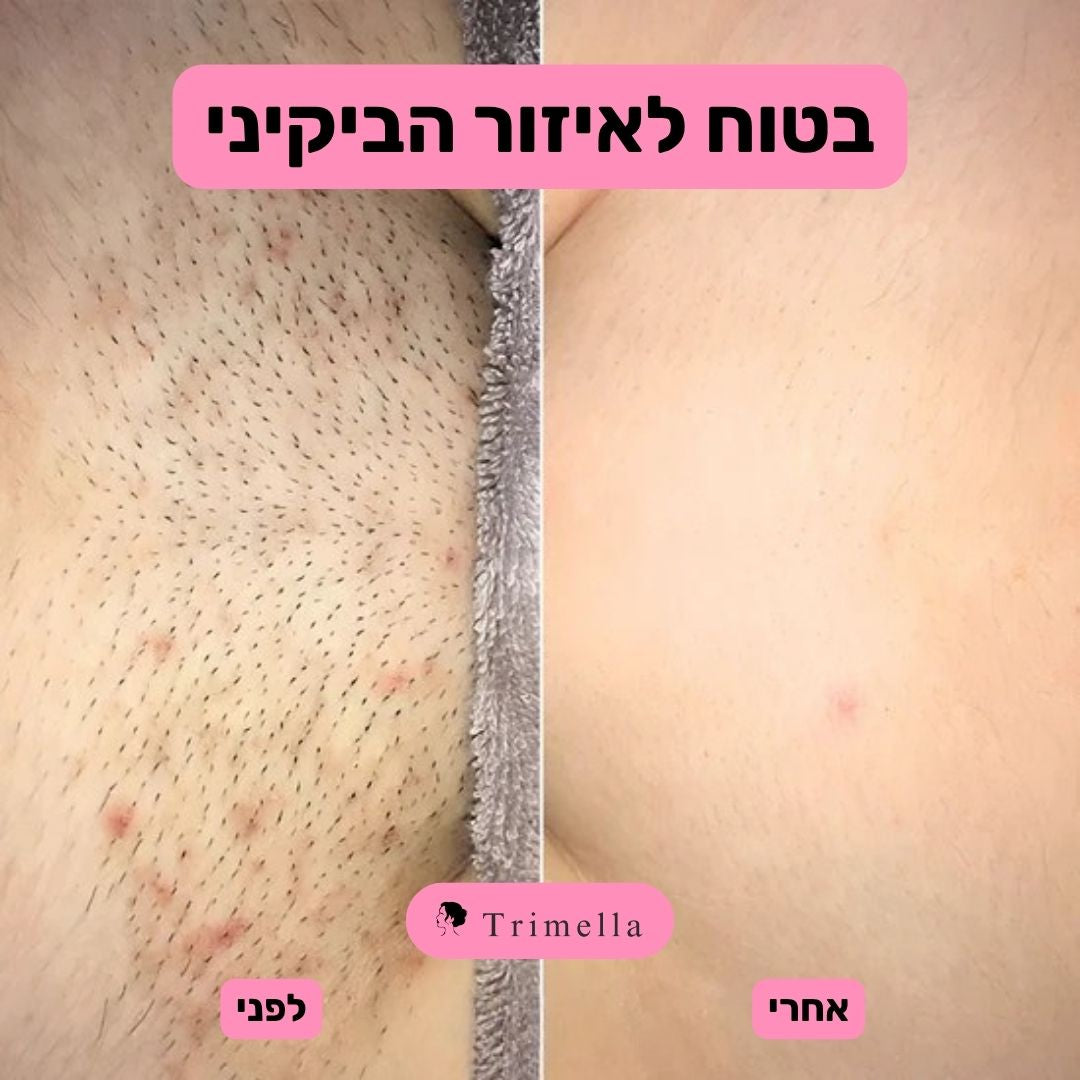 סכין גילוח מתקדמת לעור חלק ללא גירויים ושערות חודרניות - Silk Razor