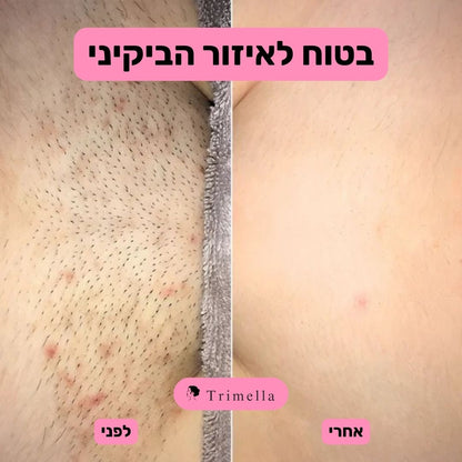 סכין גילוח מתקדמת לעור חלק ללא גירויים ושערות חודרניות - Silk Razor