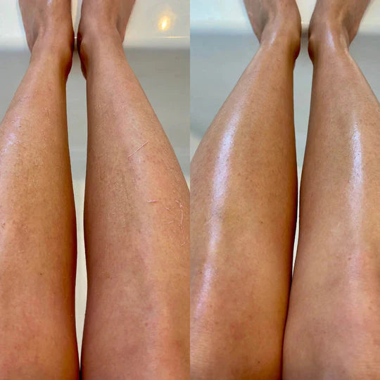 Peel ™ – כפפת פילינג מפנקת לכל הגוף