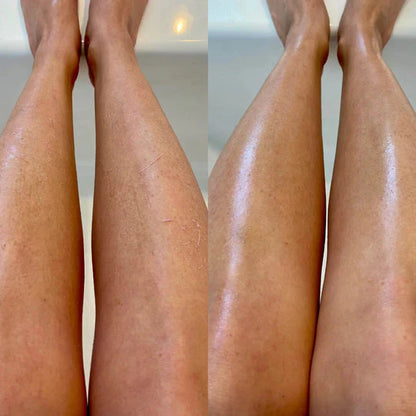 Peel ™ – כפפת פילינג מפנקת לכל הגוף