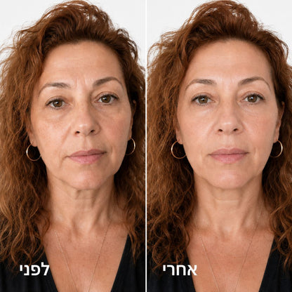 שגרת PDRN קוריאנית לעור מוצק, חלק וזוהר יותר - בלי מחטים ובלי תור לקליניקה