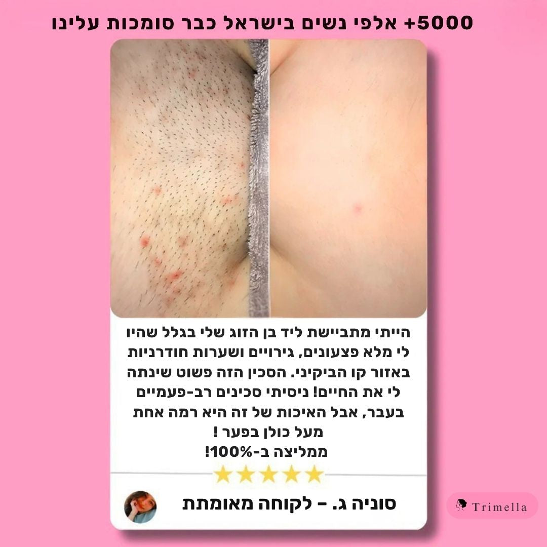 סכין גילוח מתקדמת לעור חלק ללא גירויים ושערות חודרניות - Silk Razor