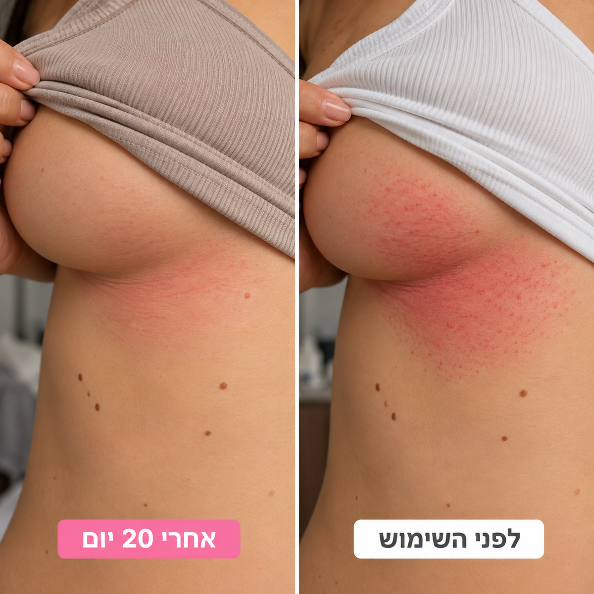קרם ייעודי להרגעת שפשפות בקפלי העור, להפחתת גירוי ולהחזרת תחושת נוחות יומיומית