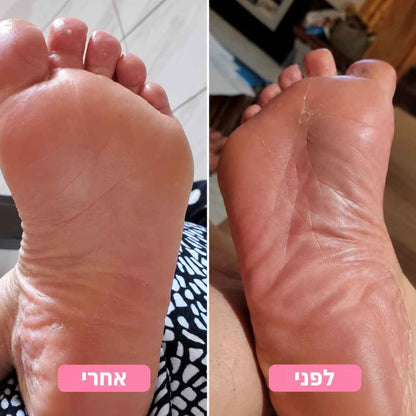 סבון טיפולי ליובש, גרד ועור הנוטה לפטריות