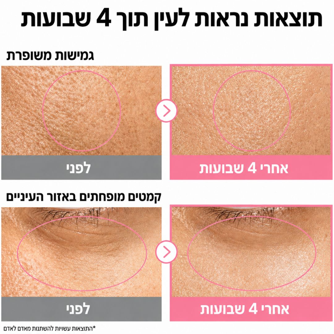 ערכת NAD9+ המלאה לסימני הגיל | סרום, אמפולת עיניים ו-4 מסכות ליפטינג