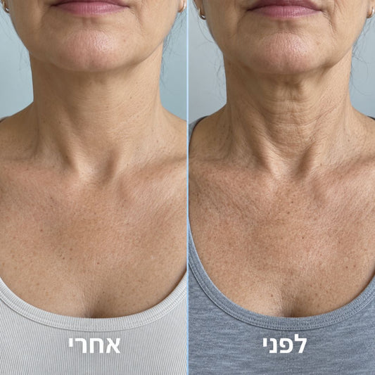 קרם לצוואר רפוי וקמטוטים - למראה מתוח, מוצק וצעיר יותר