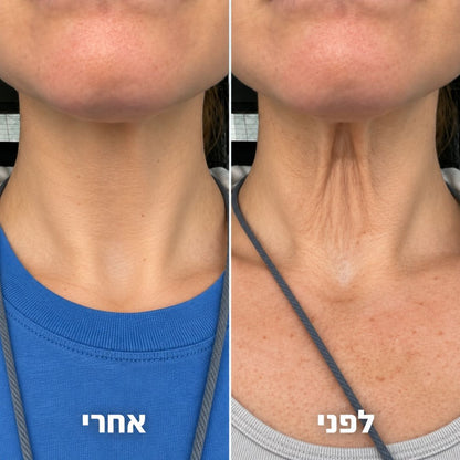 קרם לצוואר רפוי וקמטוטים - למראה מתוח, מוצק וצעיר יותר