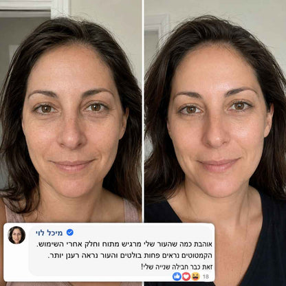 נמאס לך להיראות עייפה גם אחרי שישנת?